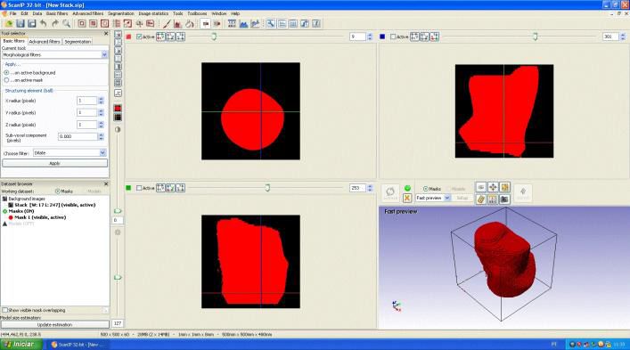 Imagem do Simpleware